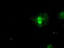 Anti-SSX2 antibody [4A11] used in Immunocytochemistry/ Immunofluorescence (ICC/IF). GTX83554