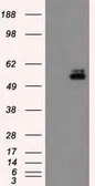 Anti-PKMYT1 antibody [2B4] used in Western Blot (WB). GTX83875