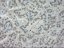 Anti-TrkC antibody [4E10] used in IHC (Paraffin sections) (IHC-P). GTX83977