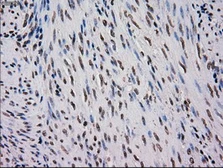 Anti-MRI1 antibody [9H7] used in IHC (Paraffin sections) (IHC-P). GTX84085