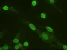 Anti-ERK3 antibody [5E1] used in Immunocytochemistry/ Immunofluorescence (ICC/IF). GTX84146