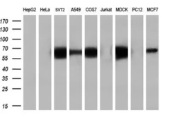 Anti-Endothelial Lipase / LIPG antibody [2A5] used in Western Blot (WB). GTX84195