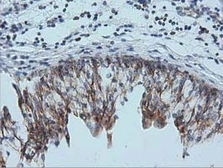 Anti-IVD antibody [1B10] used in IHC (Paraffin sections) (IHC-P). GTX84285