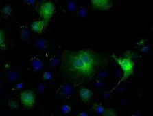Anti-IDH1 antibody [2H9] used in Immunocytochemistry/ Immunofluorescence (ICC/IF). GTX84319