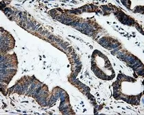 Anti-Hsp70 antibody [1B2] used in IHC (Paraffin sections) (IHC-P). GTX84337