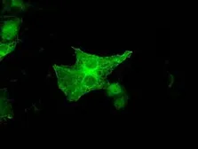 Anti-GBP2 antibody [1E5] used in Immunocytochemistry/ Immunofluorescence (ICC/IF). GTX84445