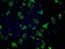 Anti-Fumarate hydratase antibody [2A2] used in Immunocytochemistry/ Immunofluorescence (ICC/IF). GTX84499