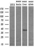 Anti-FGF2 antibody [2H11] used in Western Blot (WB). GTX84501