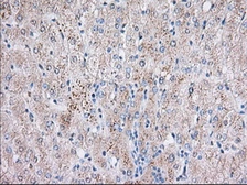 Anti-BTK antibody [10E10] used in IHC (Paraffin sections) (IHC-P). GTX84785