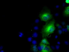 Anti-BHMT antibody [3E11] used in Western Blot (WB). GTX84828