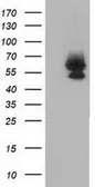 Anti-Bestrophin 3 antibody [3B11] used in Western Blot (WB). GTX84829