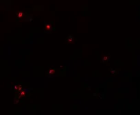 Anti-NDUFB9 antibody used in IHC (Paraffin sections) (IHC-P). GTX85007