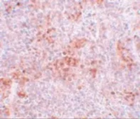Anti-BFAR antibody used in IHC (Paraffin sections) (IHC-P). GTX85010