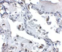 Anti-SH3BP4 antibody used in IHC (Paraffin sections) (IHC-P). GTX85017