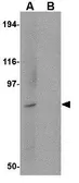 Anti-BICD1 antibody used in Western Blot (WB). GTX85029