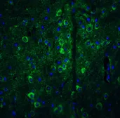 Anti-GPAM antibody used in IHC (Paraffin sections) (IHC-P). GTX85034
