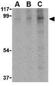 Anti-BRSK2 antibody used in Western Blot (WB). GTX85053
