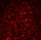 Anti-TSLP antibody used in IHC (Paraffin sections) (IHC-P). GTX85059