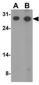 Anti-APH1A antibody used in Western Blot (WB). GTX85061