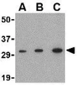 Anti-APH1A antibody used in Western Blot (WB). GTX85062