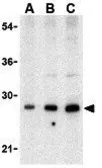 Anti-BAP29 antibody used in Western Blot (WB). GTX85073