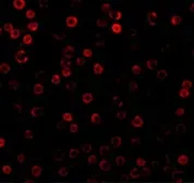 Anti-DAD1 antibody used in Immunocytochemistry/ Immunofluorescence (ICC/IF). GTX85083
