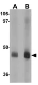 Anti-EFCAB4A antibody used in Western Blot (WB). GTX85143