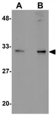 Anti-ALKBH2 antibody used in Western Blot (WB). GTX85166