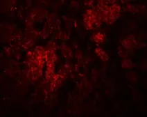 Anti-CCDC106 antibody used in IHC (Paraffin sections) (IHC-P). GTX85167