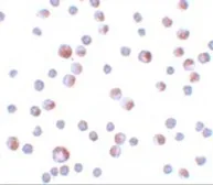 Anti-TCTN3 antibody used in Immunocytochemistry/ Immunofluorescence (ICC/IF). GTX85175