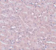 Anti-FRMPD2 antibody used in IHC (Paraffin sections) (IHC-P). GTX85236