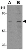 Anti-NOTUM antibody used in Western Blot (WB). GTX85260