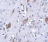 Anti-ATOH8 antibody used in IHC (Paraffin sections) (IHC-P). GTX85296