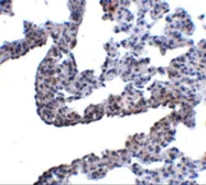 Anti-PCDH12 antibody used in IHC (Paraffin sections) (IHC-P). GTX85342