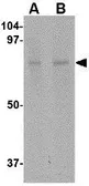 Anti-ZBTB1 antibody used in Western Blot (WB). GTX85357