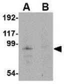 Anti-JPH4 antibody used in Western Blot (WB). GTX85362