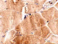 Anti-JPH2 antibody used in IHC (Paraffin sections) (IHC-P). GTX85364