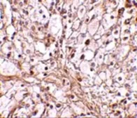 Anti-TRIM30 antibody used in IHC (Paraffin sections) (IHC-P). GTX85386