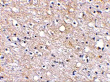 Anti-Plxdc2 antibody used in IHC (Paraffin sections) (IHC-P). GTX85420
