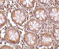 Anti-TEM1 antibody used in IHC (Paraffin sections) (IHC-P). GTX85429