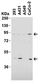 Anti-TEM1 antibody used in Western Blot (WB). GTX85430