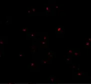 Anti-ORAI2 antibody used in Immunocytochemistry/ Immunofluorescence (ICC/IF). GTX85443