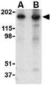 Anti-Nogo A antibody used in Western Blot (WB). GTX85448