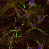 Anti-GAD67 antibody used in Immunocytochemistry/ Immunofluorescence (ICC/IF). GTX85453