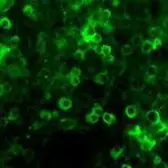 Anti-Netrin 1 antibody used in Immunohistochemistry (IHC). GTX85458