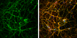 Anti-NF-M antibody used in Immunocytochemistry/ Immunofluorescence (ICC/IF). GTX85461