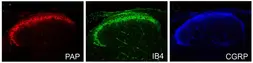 Anti-Prostatic Acid Phosphatase antibody used in IHC (Paraffin sections) (IHC-P). GTX85463