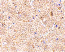 Anti-VISA antibody used in IHC (Paraffin sections) (IHC-P). GTX85480