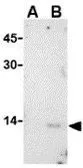 Anti-West Nile virus Capsid protein antibody used in Western Blot (WB). GTX85509