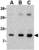 Anti-Noxa antibody used in Western Blot (WB). GTX85521